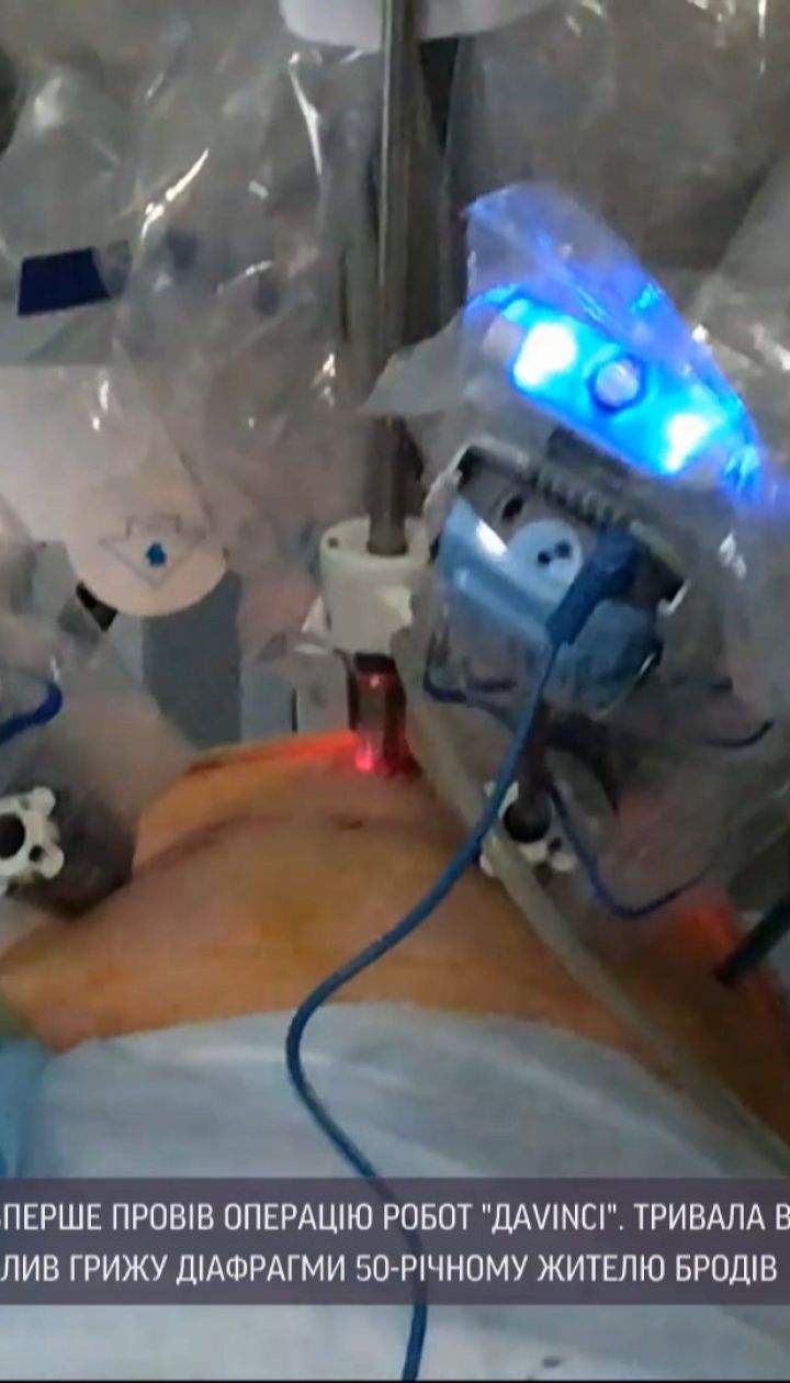 Робот-хірург на ім'я Да Вінчі вперше провів операцію у Львові