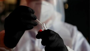 В Україні попередили про небезпеку індійського штаму коронавірусу, який вражає шлунок і нирки