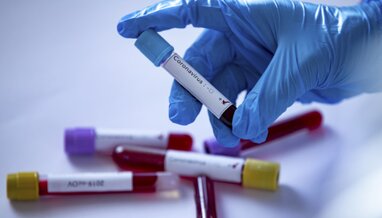 В Україні за добу підтвердили 623 нових випадки зараження коронавірусом