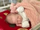 У Львові лікарі видалили півкілограмові пухлини у трьох немовлят