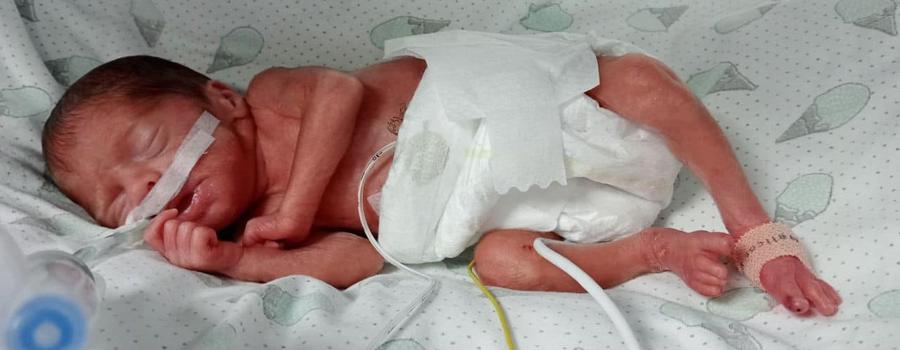 У Львові лікарям вдалося врятувати дитину, яка народилася з вагою 600 грамів