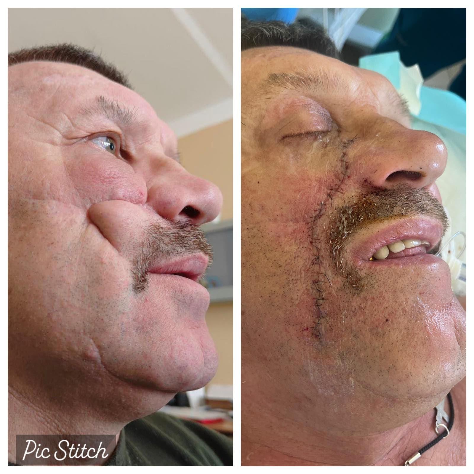 Обличчя пацієнта до і після операції